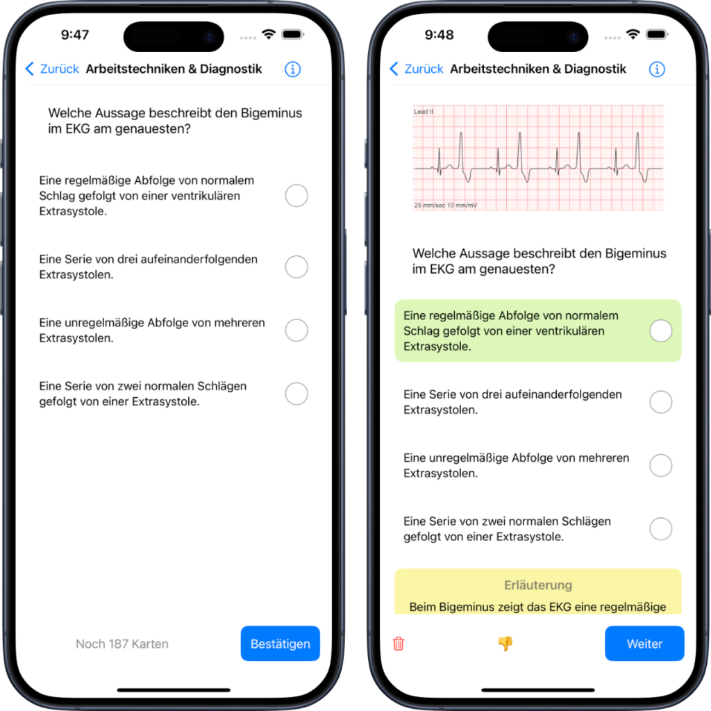 Weitere Darstellung einer EKG Abbildung als Multiple Choice mit Antwort innerhalb der NotSan App